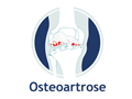 Logo do site Osteoartrose